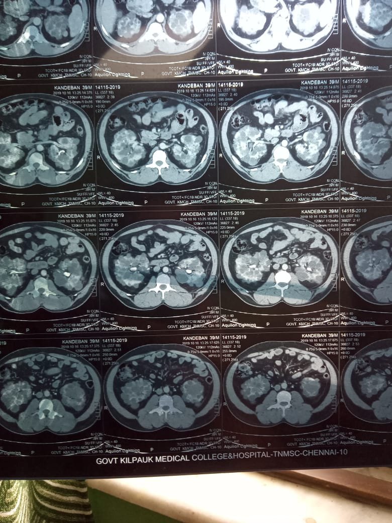 A Challenge in the COVID Pandemic